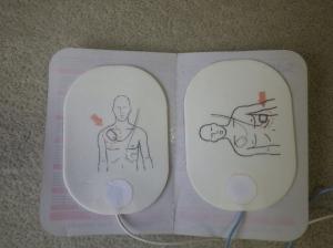 まだ傷病者に貼る前の、それぞれに貼る箇所が印刷されている2枚の電極パッドの写真