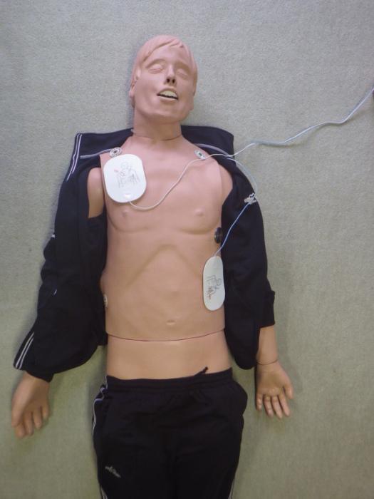 電極パッドの貼付例を示した写真。右前胸部及び左側胸部の位置に電極パッドが貼り付けられている。